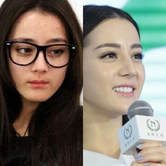 10位素顏女星前后對比，哪位才是你素顏女神。
