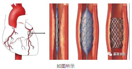 A股風(fēng)云突變！創(chuàng)業(yè)板大跌原因揭秘